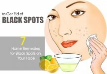Remove Black Spots on face