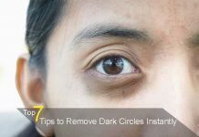 Remove Dark circles under Eyes
