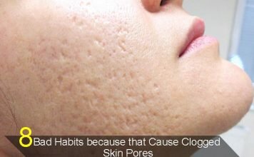 Clogged skin pores