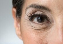 best ways for Wrinkle Remover Tips to get rid of Wrinkle Treatment